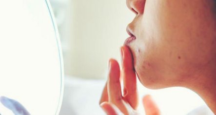 receitas para pele com espinhas