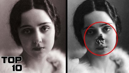 Top 10 Medical Mistakes Doctors Made On REAL People