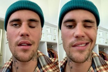 justin bieber face