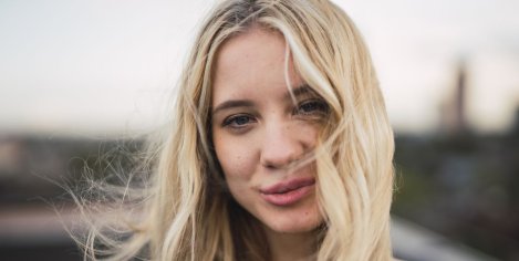 recetas contra la caspa